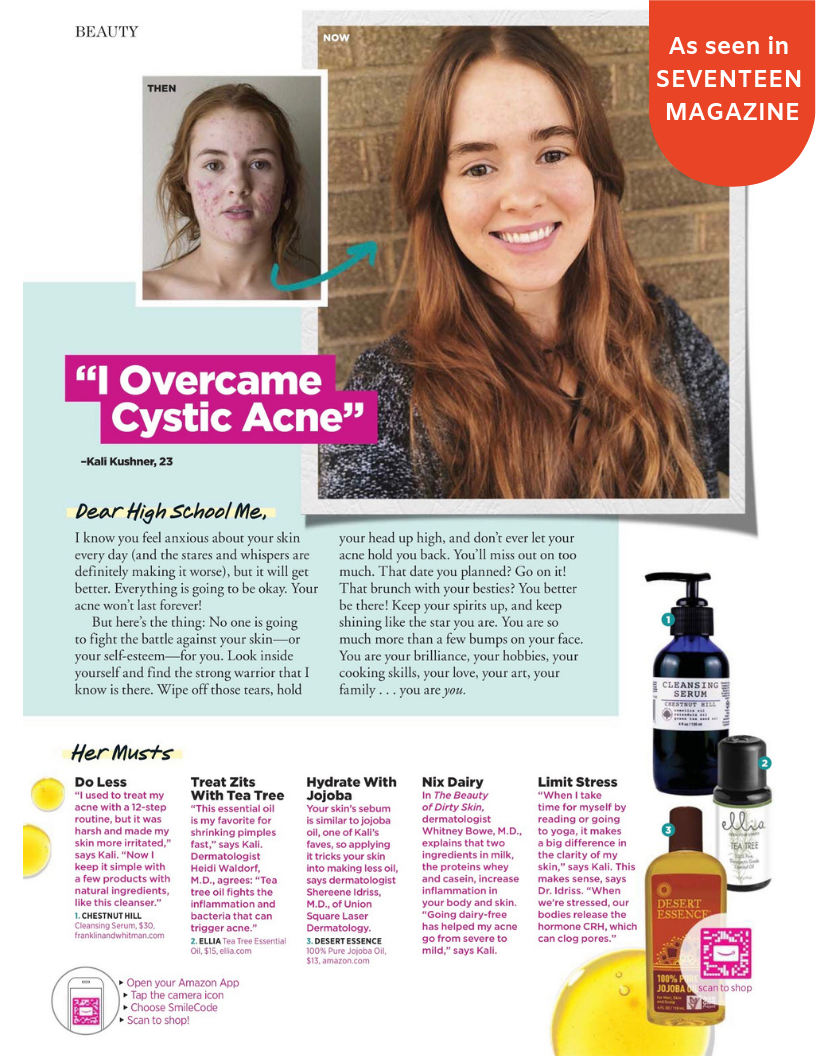 Seventeen Magazine page with Chestnut Hill Cleansing Serum on it